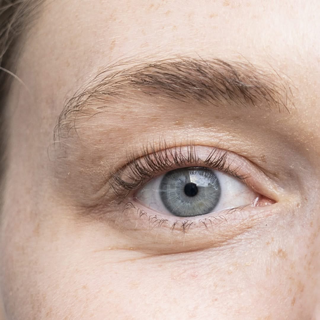 Øjenvippeserum
